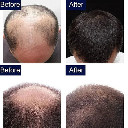 7 Day Rapid Hair Growth Serum